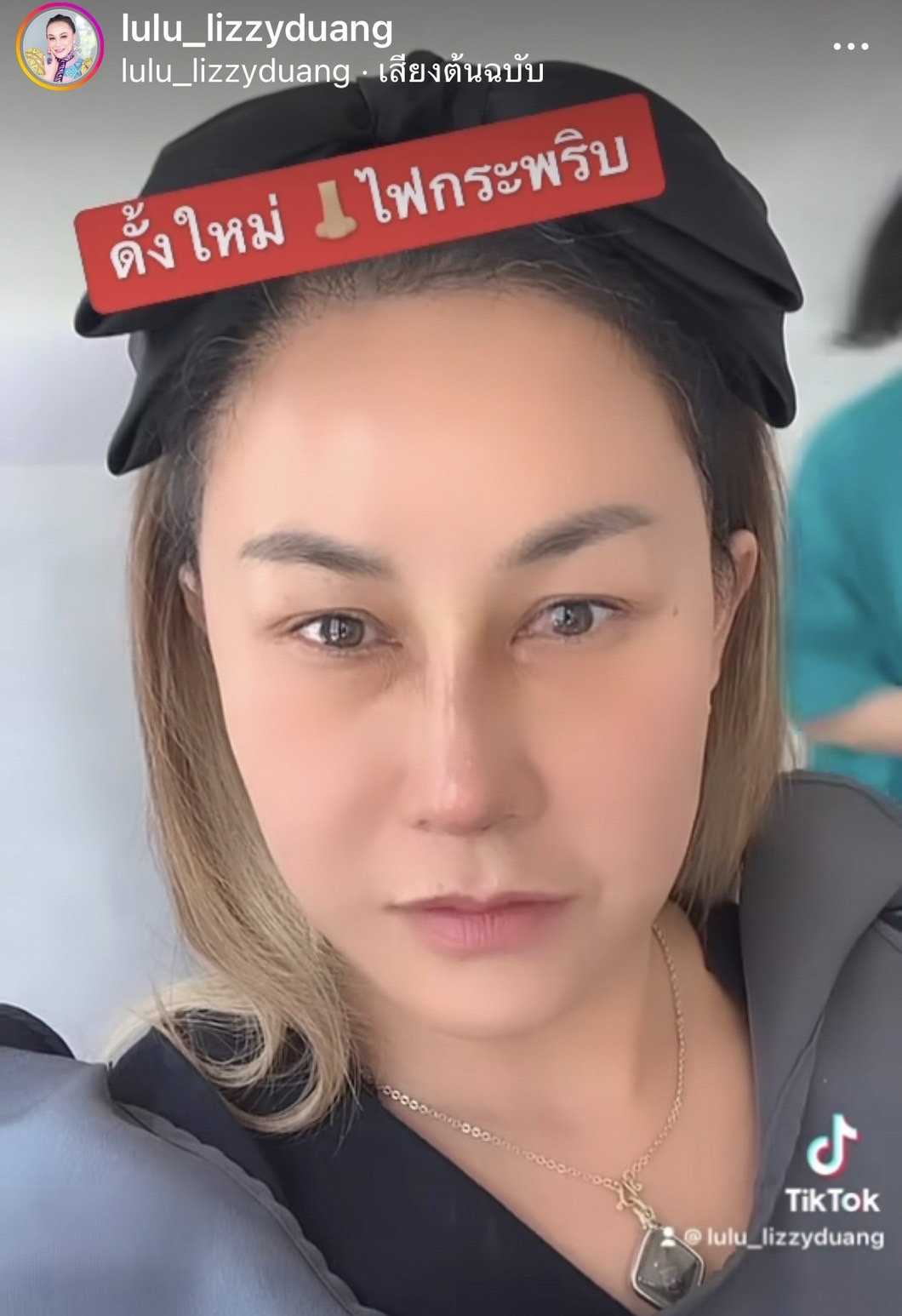 ลูลู่  อวดจมูกใหม่ สวยสมใจ!! หลังขึ้นเขียงทำศัลยกรรมครั้งแรก!! 