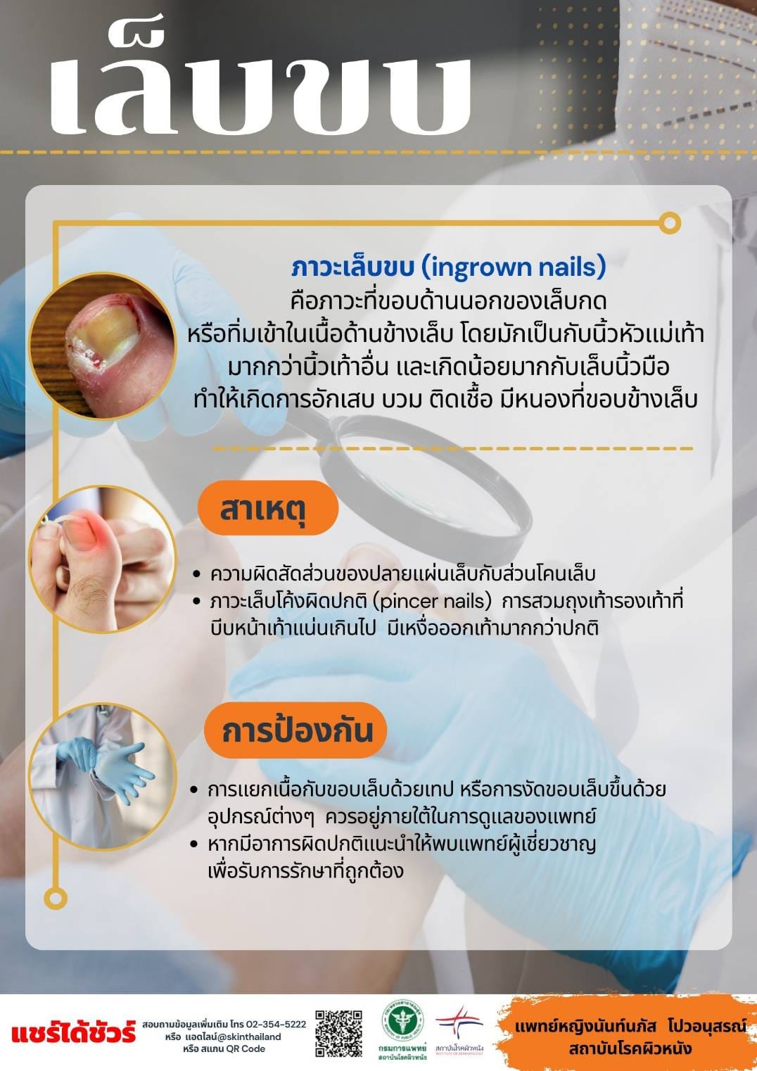 เล็บขบ  สาเหตุเกิดจากอะไร? ดูแลทำความสะอาดแผลอย่างไรไม่ให้ติดเชื้อ