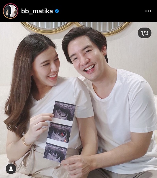 บี มาติกา เผยภาพอัลตร้าซาวด์ บอกลูกชายหน้าคล้ายปะป๊า!!