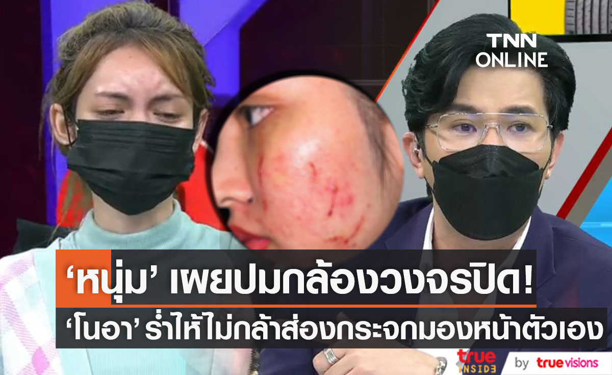 "หนุ่ม กรรชัย" เผยปมกล้องวงจรปิด กรณี "โนอา" ถูกทำร้าย ร่ำไห้ไม่กล้าส่องกระจกดูหน้าตัวเอง 