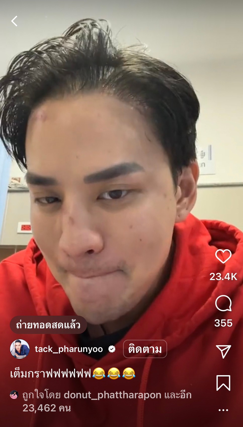 “แทค ภรัณยู” จมูกหัก! หลังแพ้ศึก IDOL FIGHT 3 “แทค ภรัณยู” จมูกหัก! หลังแพ้ศึก IDOL FIGHT 3