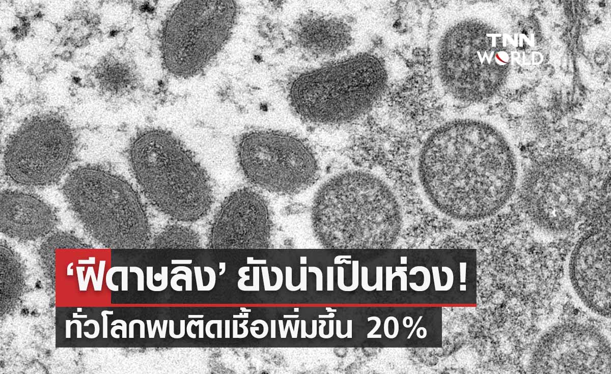 ฝีดาษลิง ยังน่าห่วง! ทั่วโลกพบติดเชื้อเพิ่มขึ้น 20% 