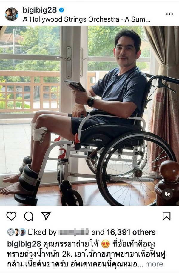 อัปเดตอาการล่าสุด บิ๊ก ศรุต หลังเข้ารับการผ่าตัดรักษา ขาฉิ่ง Knock knee อัปเดตอาการล่าสุด บิ๊ก ศรุต หลังเข้ารับการผ่าตัดรักษา ขาฉิ่ง Knock knee