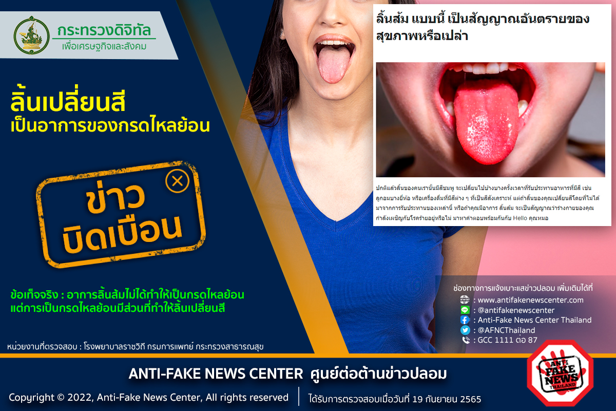 สังเกต ‘ลิ้นเปลี่ยนสี’ ใช่อาการแรกเริ่มของกรดไหลย้อนหรือไม่? สังเกต ‘ลิ้นเปลี่ยนสี’ ใช่อาการแรกเริ่มของกรดไหลย้อนหรือไม่?