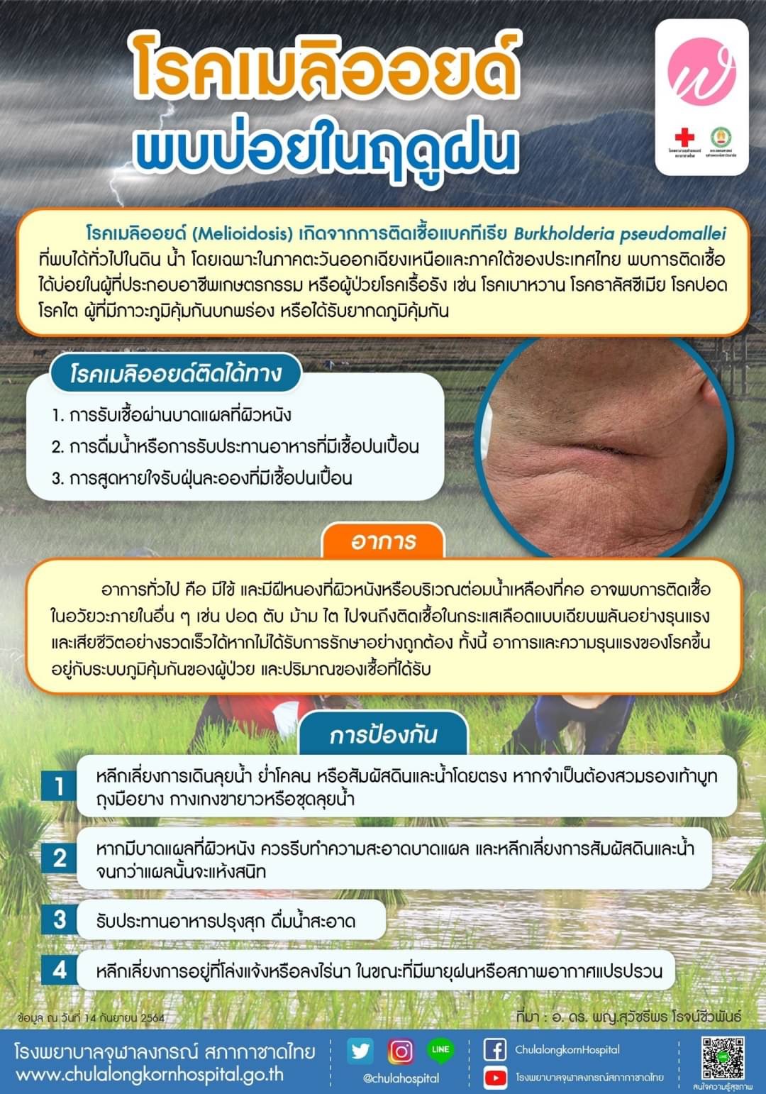โรคเมลิออยด์ พบบ่อยในฤดูฝน ติดต่อทางไหน มีอาการอย่างไร