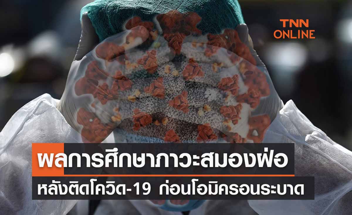 หมอธีระเผยผลศึกษา ‘ภาวะสมองฝ่อ’ หลังติดโควิด 