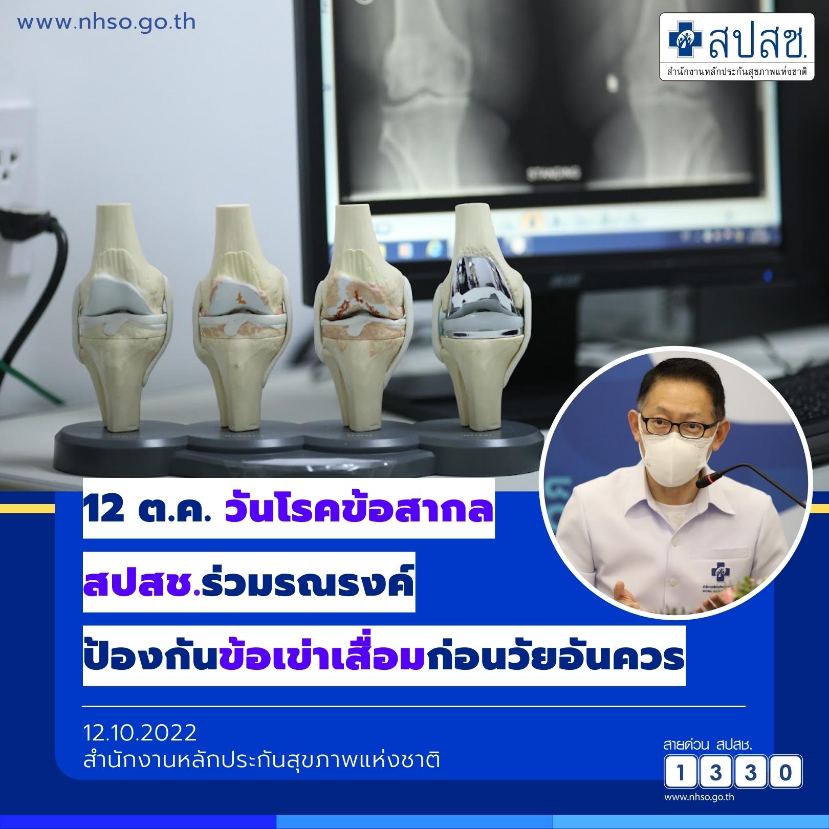ข้อเข่าเสื่อม ใช้สิทธิบัตรทอง 30 บาท ผ่าตัดเปลี่ยนข้อเข่าเทียมได้แล้ว ข้อเข่าเสื่อม ใช้สิทธิบัตรทอง 30 บาท ผ่าตัดเปลี่ยนข้อเข่าเทียมได้แล้ว