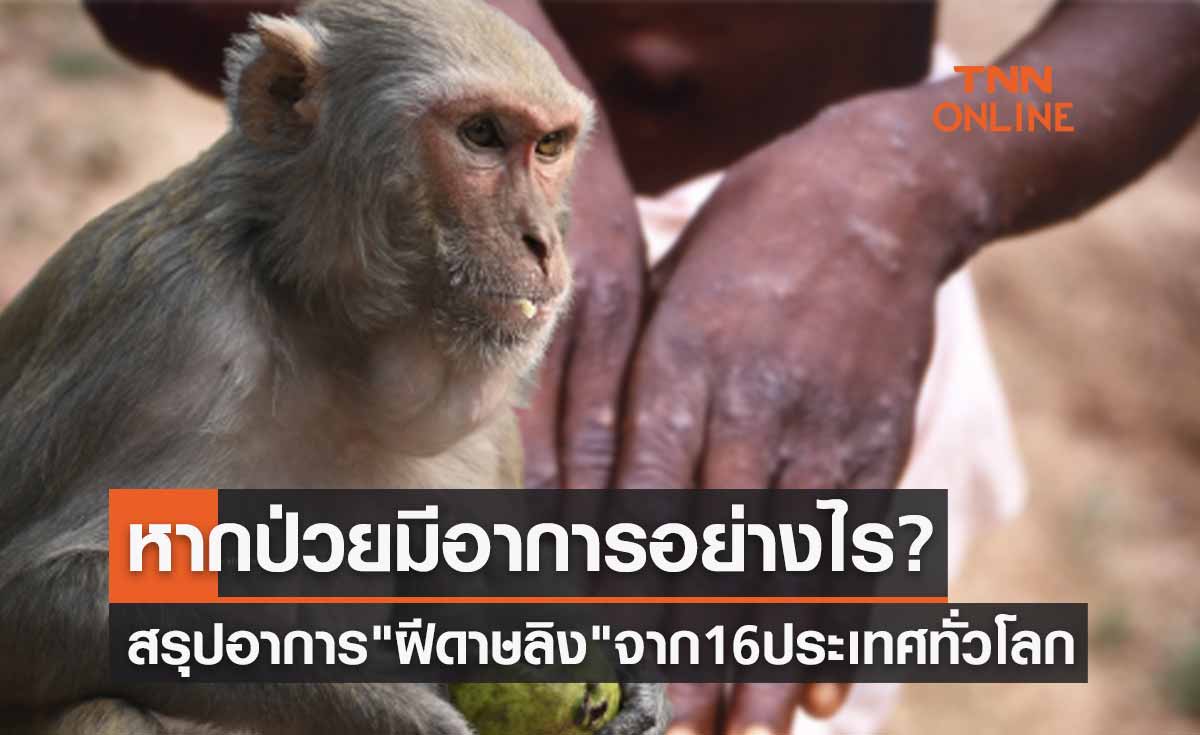 สรุปอาการ "ฝีดาษลิง" จาก 16 ประเทศทั่วโลก หากป่วยมีอาการอย่างไร?