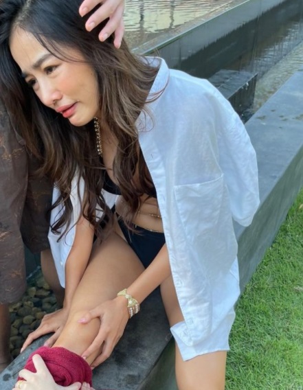 กระแต อาร์สยาม อัปเดตอาการล่าสุด เย็บแผลไป 17 เข็ม กระแต อาร์สยาม อัปเดตอาการล่าสุด เย็บแผลไป 17 เข็ม