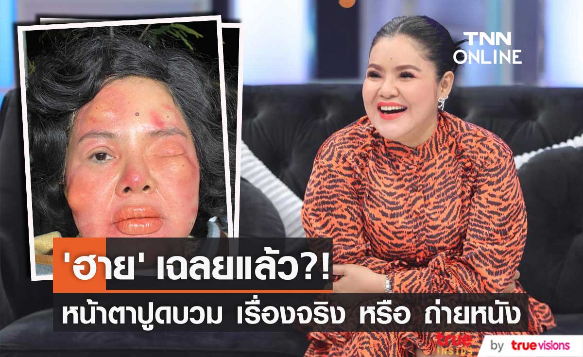 "ฮาย อาภาพร" เฉลยแล้ว! หลังโพสต์ภาพหน้าตาปูดบวม ทำแฟนคลับเป็นห่วง... (มีคลิป)