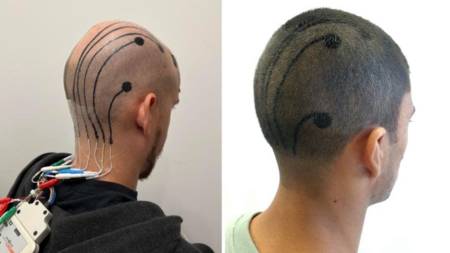นวัตกรรมรอยสักแบบพิมพ์ e-tattoo สำหรับช่วยอ่านค่าสมอง