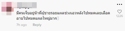 ปาระเบิด!! กลางคอนเสิร์ต ยังโอม เผยเหตุระทึก มีผู้บาดเจ็บเลือดอาบ