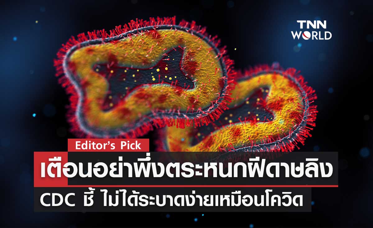 CDC สหรัฐฯ เตือนอย่าพึ่งตระหนกฝีดาษลิง แม้หลายชาติแห่ซื้อวัคซีนและยารักษา
