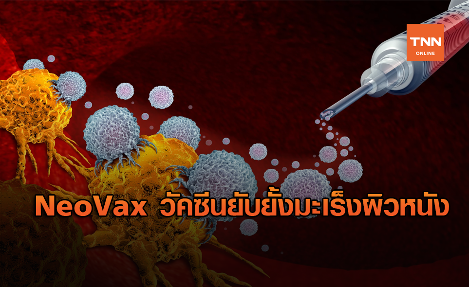 NeoVax วัคซีนยับยั้งมะเร็งผิวหนัง จัดการให้โรคสงบเงียบยิดอายุผู้ป่วย